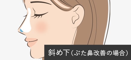 鼻尖4Dノーズ（イメージ）