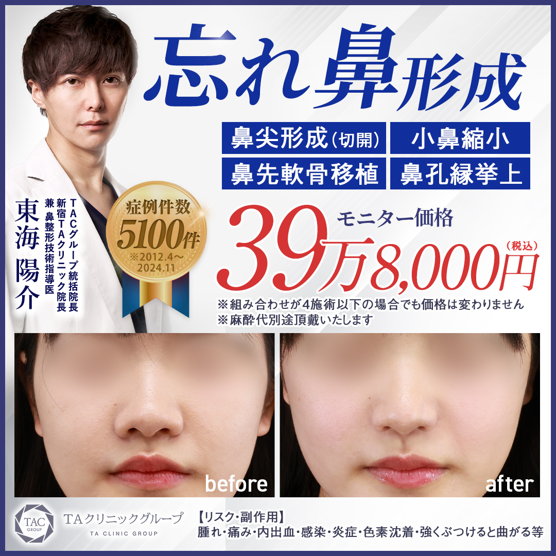 東海医師_忘れ鼻形成_モニター募集