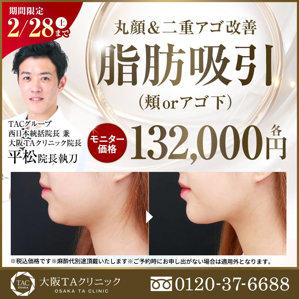 平松医師_頬orアゴ下の脂肪吸引_モニター募集
