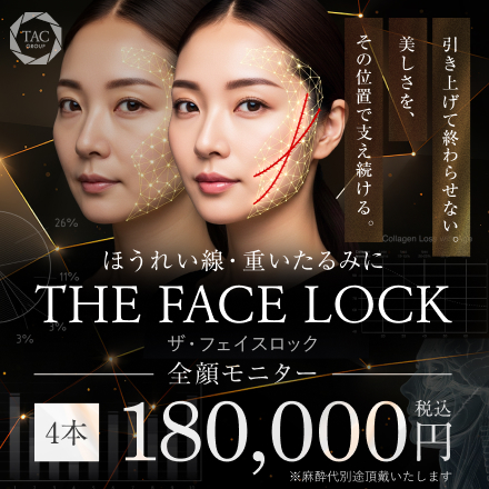 ザ・フェイスロック