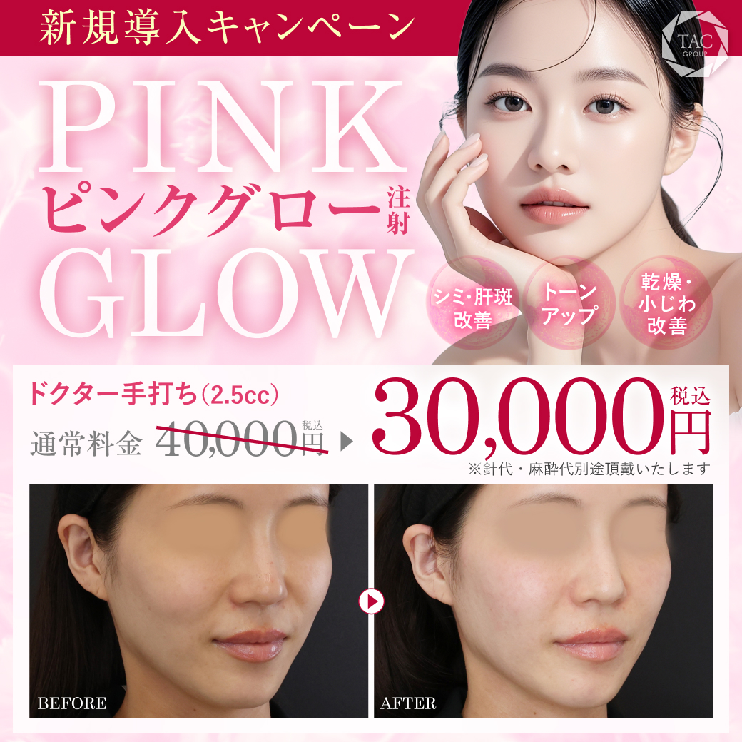 ピンクグロー_キャンペーン価格